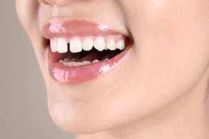 Signs That You May Need Composite Bonding - Essential Dental Care