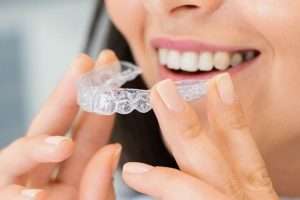 Composite Bonding vs Alternatives Which Option Is Right for You - Essential Dental Care - Essential Dental Care