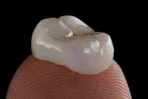 Composite Bonding vs Alternatives Which Option Is Right for You - Essential Dental Care