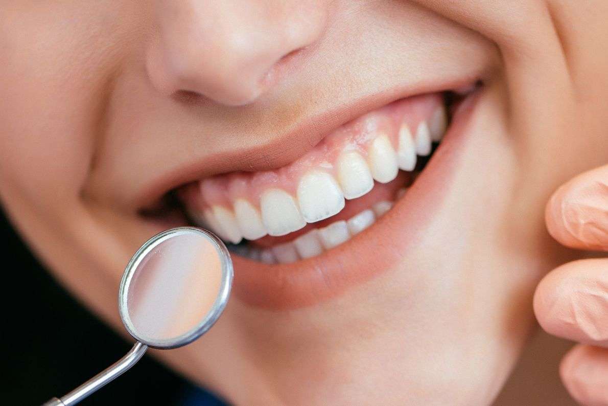 Composite Bonding vs Alternatives: Which Option Is Right for You?