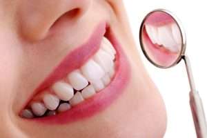 How Long Does Composite Bonding Last?