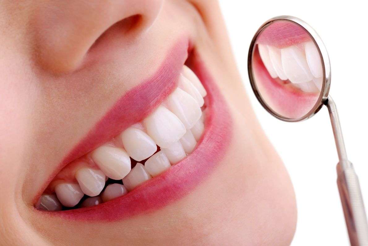How Long Does Composite Bonding Last?