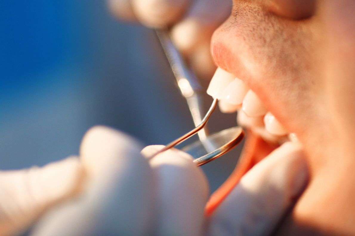 Is Composite Bonding Painful?